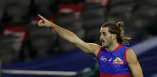 Injury setback for Western Bulldogs forward Josh Bruce
