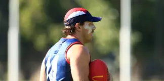 Melbourne confirm surgery blow for forward Tom McDonald