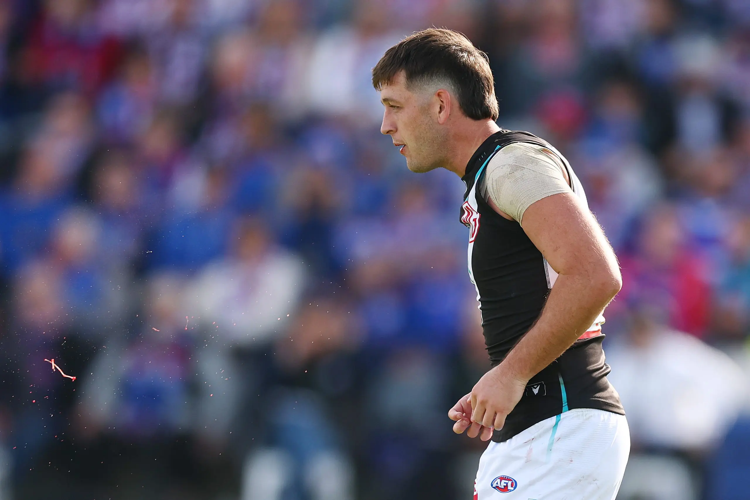 BALLARAT, AUSTRALIA - MAY 03: Blood can be seen in the mouth of Zak Butters of the Power during the round eight AFL match between Western Bulldogs and Port Adelaide Power at Mars Stadium, on May 03, 2025, in Ballarat, Australia. (Photo by Morgan Hancock/Getty Images)