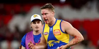 Luckless Eagle suffers yet another head knock as “concerned” coach worries for future MELBOURNE, AUSTRALIA - MAY 10: Harry Edwards of the Eagles is assisted off the ground under the blood rule during the round nine AFL match between Melbourne Demons and West Coast Eagles at Marvel Stadium, on May 10, 2026, in Melbourne, Australia. (Photo by Josh Chadwick/Getty Images)