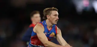 Western Bulldogs defender season in doubt MELBOURNE, AUSTRALIA - MAY 24: Bailey Dale of the Bulldogs runs with the ball during the round 11 AFL match between Western Bulldogs and Narrm (Melbourne Demons) at Marvel Stadium, on May 24, 2026, in Melbourne, Australia. (Photo by Robert Cianflone/Getty Images)