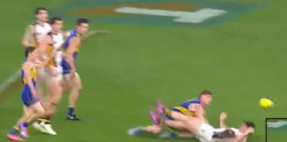 AFL MRO: West Coast star set to miss start of 2027 AFL MRO: West Coast star set to miss start of 2027
