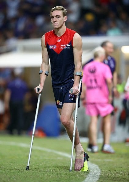 DARWIN, AUSTRALIA - JULY 09: Oscar McDonald of the Demons is seen after the match with an injury during the round 16 AFL match between the Melbourne Demons and the Fremantle Dockers at TIO Stadium on July 9, 2016 in Darwin, Australia.  (Photo by Robert Cianflone/Getty Images)