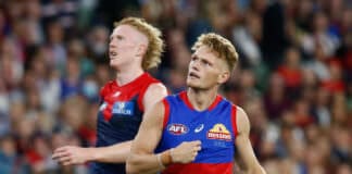 Injury concerns remain around Bulldogs mid Adam Treloar