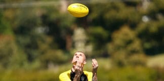 Foot complaint sidelines star Tiger Tom Lynch, Balme states areas of improvement