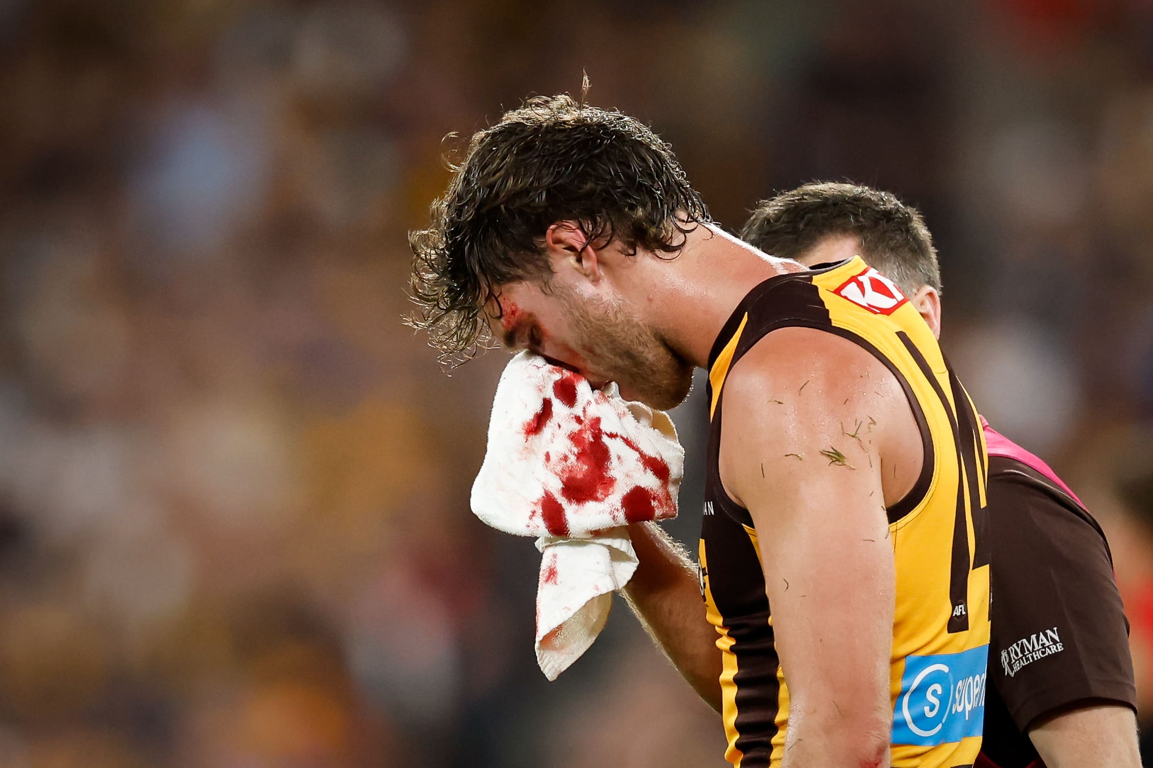 MELBOURNE, AUSTRALIA - MARCH 14: Jack Scrimshaw of the Hawks leaves the field under the blood rule during the 2025 AFL Round 01 match between the Hawthorn Hawks and the Essendon Bombers at the Melbourne Cricket Ground on March 14, 2025 in Melbourne, Australia. (Photo by Dylan Burns/AFL Photos via Getty Images)