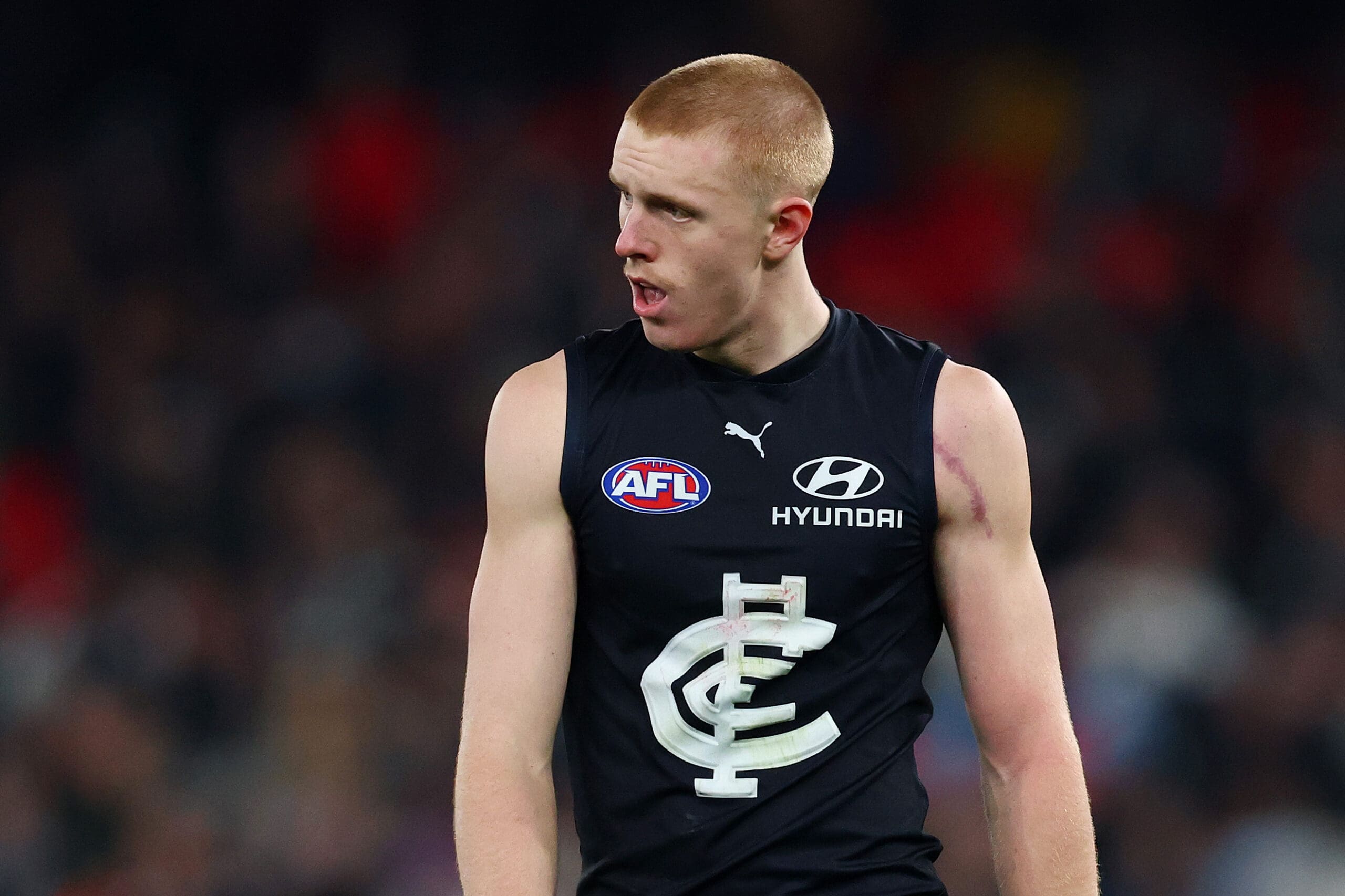Carlton’s Josh Fraser on when Harry Dean will return, Nick Haynes talks controversy